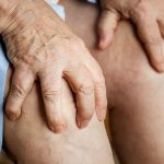 تعویض مفصل افراد دیابتی